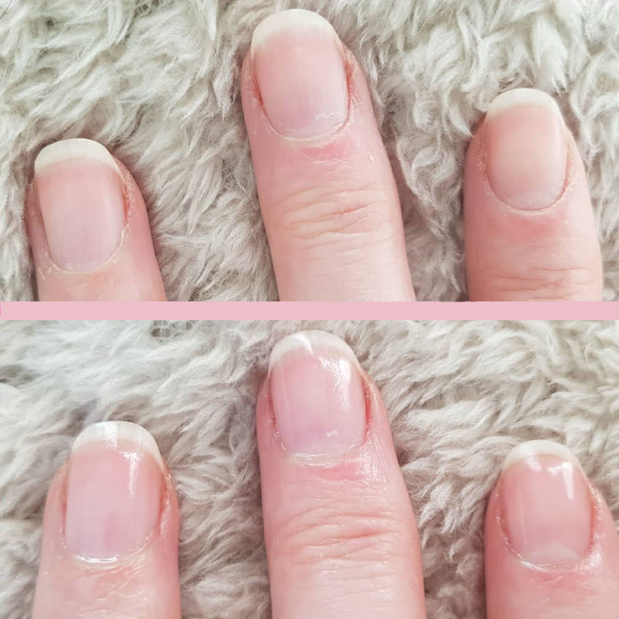 Ногти до и после обработки